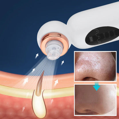 Mitesser-Entferner & Hydrodermabrasionsgerät – Porentiefe Hautreinigung mit Vakuum-Technologie