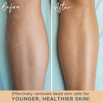Peeling-Badehandschuhe – Exfolierende Duschhandschuhe für Sanfte Haut im 2er-Set