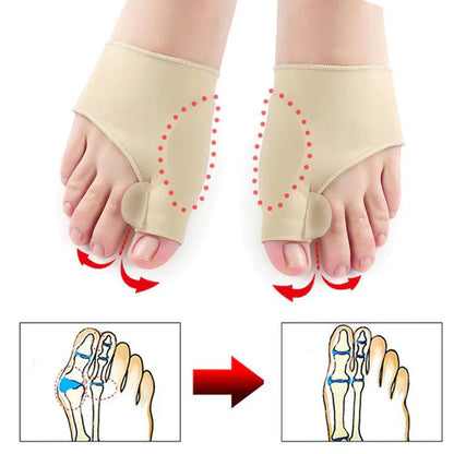 Hallux-Valgus Korrekturstütze (1 Paar) – Effektiver Schutz für Deine Füße