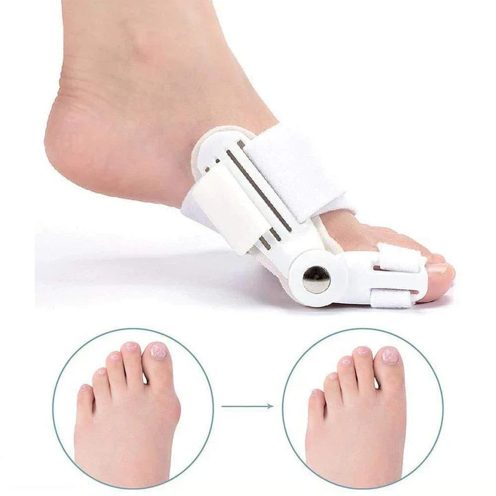 Orthopädische Hallux-Valgus-Schiene (1 Paar)