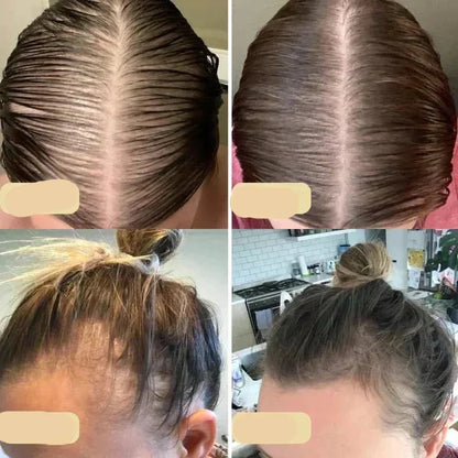 Veganes Haarwuchsöl – Natürlicher Haarwachstumsbooster für Volles Haar