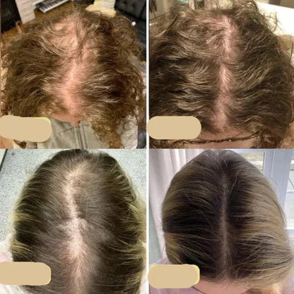 Veganes Haarwuchsöl – Natürlicher Haarwachstumsbooster für Volles Haar