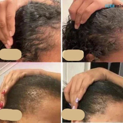 Veganes Haarwuchsöl – Natürlicher Haarwachstumsbooster für Volles Haar